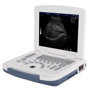 Ultrasound Machine Full Digital Ultrasonic Devices Ultrasound Diagnostic System