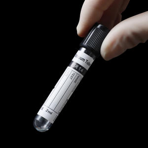 ESR Tube Sodium Citrate 1: 4 Vacuum Blood Collection Tube