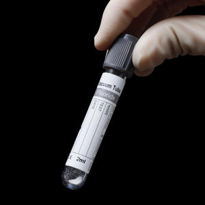 EDTA+Naf Vacuum Blood Collection Tube Grey Cap