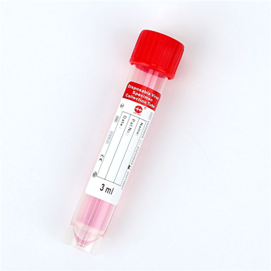Disposable Virus Specimen Collection Tube
